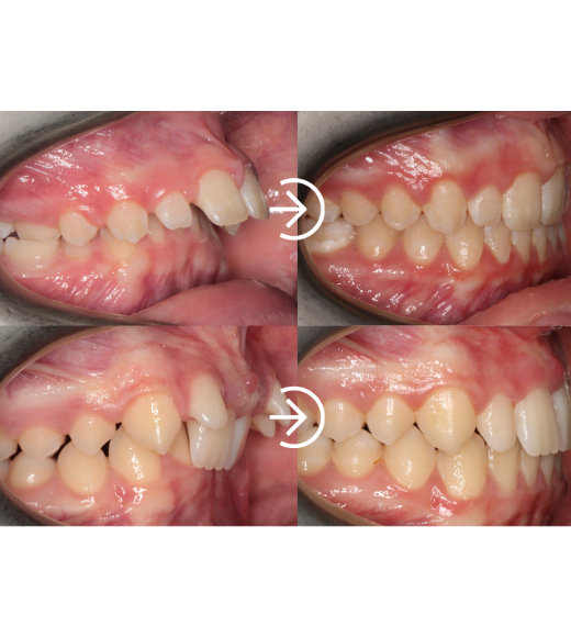 Before treatment - Case 1