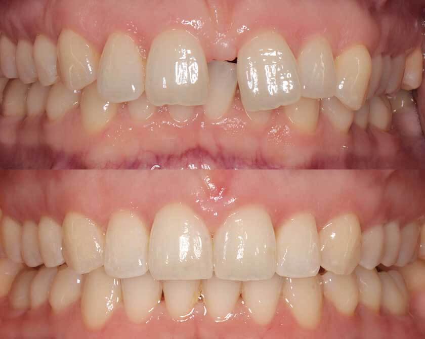 ceramic-results-TJ