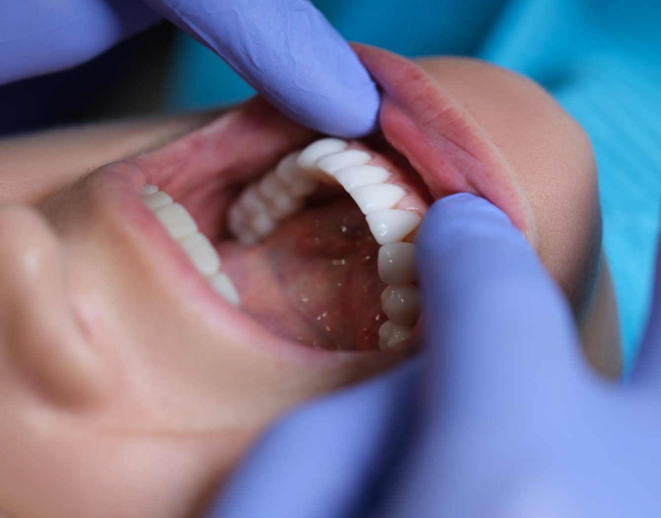 Dental hygiene treatment at The Orthodontic Centre
